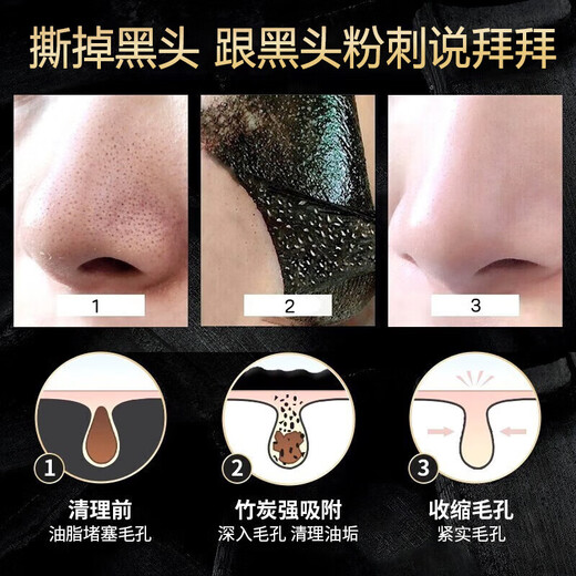 Ice chrysanthemum bamboo charcoal blackhead removal three-piece peel-off mask to shrink enlarged pores, closed mouth powder, pungent nose patch, T-zone care for men and women, 2 sets, affordable pack