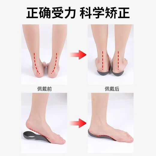 O-shaped leg flat foot correction foot valgus, calf valgus correction leg shape artifact straight leg foot half palm invisible tool M code 35-39 white 1 pair