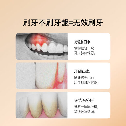 惠百施65孔宽头软毛牙刷成人超高效Pro+清新口腔护龈1支颜色随机