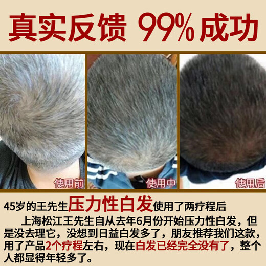 En la cancha interna, use el cabello blanco Beijing Tongrentang Polygonum multiflorum Ganoderma Lucidum para promover la alimentación natural y curar las raíces de las personas jóvenes, de mediana edad y mayores para eliminar la caspa. Reparar 500 ml 1 botella Polygonum Multiflorum Cabello negro