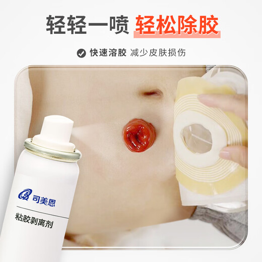 司美恩造口黏胶去除剂12010造口袋护理用品附件医用造瘘口底盘剥离剂 60ml/瓶