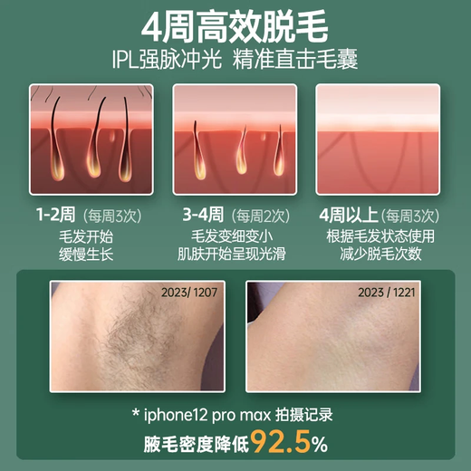 Konka Medical Standard Konka Hair Removal Device Freezing Point Laser Hair Removal Device Painless Home Full Body Shaving Artifact Gift Medical Grade Standard Red Light Wave + Painless Forced Cold Ice Removal