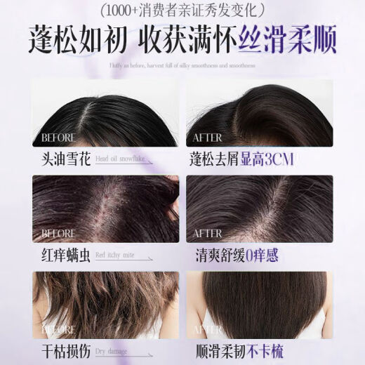 Chuman Amino Acid Donglai Shampoo Oil Control Fluffy Anti-dandruff Relieve Itchy Men and Women Shampoo Long-lasting Flavor [Industry Sales Crown] Mulan Xiang Shampoo 800ml Top 10 Shampoos in the Top 10 in the domestic products
