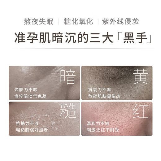 Kangaroo Mother's Light Brightening Skin Care Products for Pregnant Women, Facial Cleanser, Cream Set, 4-piece Set for Anti-Yellowing and Improvement of Dullness