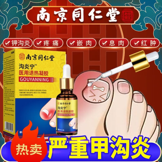 Nanjing Tongrentang specializes in treating paronychia, special treatment for ingrown toenails, redness, swelling and pain, granulation and polyp removal, swelling and suppuration, deep foot care 1 box Tongrentang