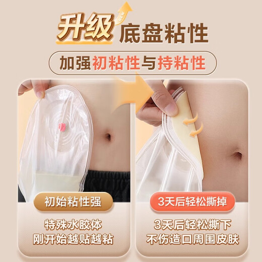 可孚造口袋一件式一次性肛肠罩漏腰带人工肛门直肠癌改道造瘘大便 买5送2共7盒】5009夹子款造口袋70个+赠护理
