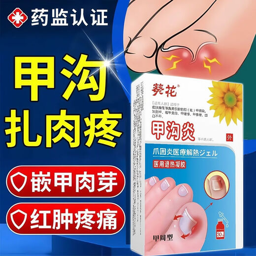 Nanjing Tongrentang specializes in treating paronychia, special treatment for ingrown toenails, redness, swelling and pain, granulation and polyp removal, swelling and suppuration, deep foot care 1 box Tongrentang