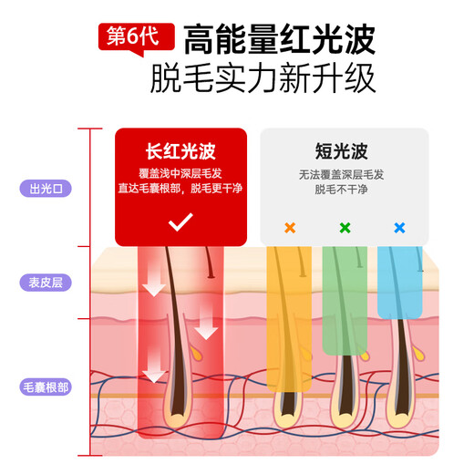 Konka Medical Standard Konka Hair Removal Device Freezing Point Laser Hair Removal Device Painless Home Full Body Shaving Artifact Gift Medical Grade Standard Red Light Wave + Painless Forced Cold Ice Removal