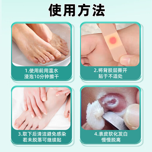 Yunnan herbal corn patch corn ointment to remove thorns on the roots of the feet, painless removal of flat warts, calluses on hands and feet, soles and toes warts