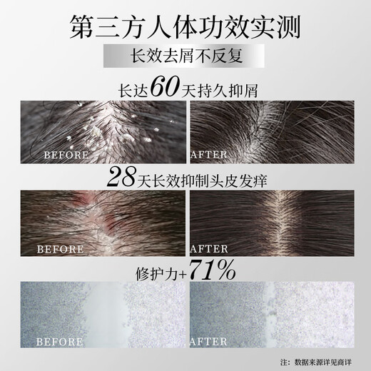 Ziyuan [Menziyi same style] 1% selenium disulfide anti-dandruff anti-itchi shampoo Blue Aurora men and women shampoo 215g