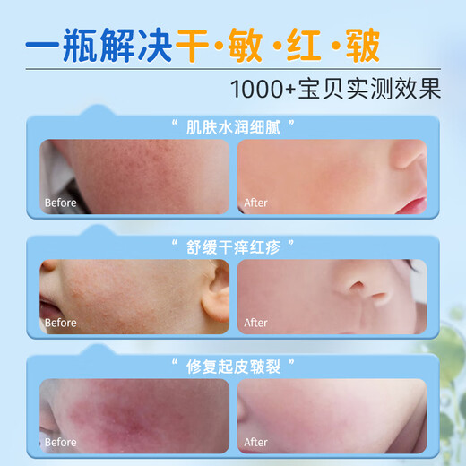 Masata Singapore imported children's facial cream baby infant 0-3-12 years old moisturizing autumn and winter face moisturizing 50g