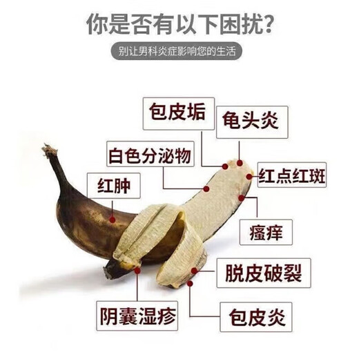 Mupirocin ointment, a special medicine for leucocephalitis, relieves itching, anti-inflammatory, fungal infection, private postdermatitis, skin redness, swelling, erosion, ulcers, pearl rash, dermatitis medicine, 1 box, Mupirocin ointment, authentic Chinese medicine, approved by Chinese medicine, OTC same-day pharmacy delivery