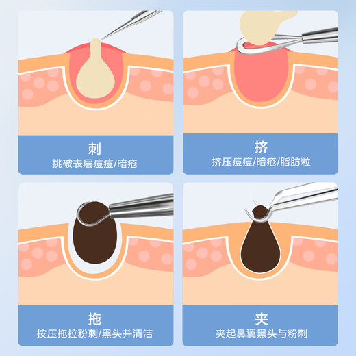 Made in Tokyo, acne needle, blackhead removal, cell clip set, acne removal needle, tweezers, acne picking, beauty salon cleaning tools