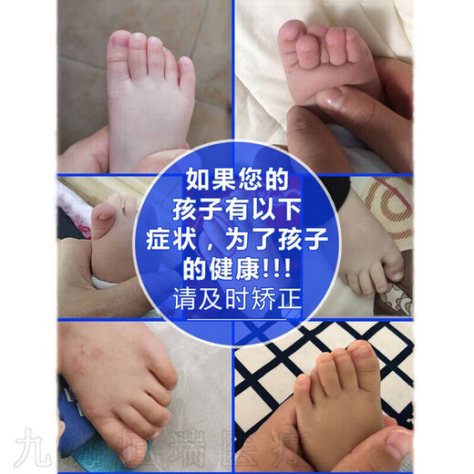 婴儿童脚趾头小孩大拇指外翻器宝宝重叠分离器分趾大母指内扣 829儿童5趾重叠舒适款6-12岁蓝