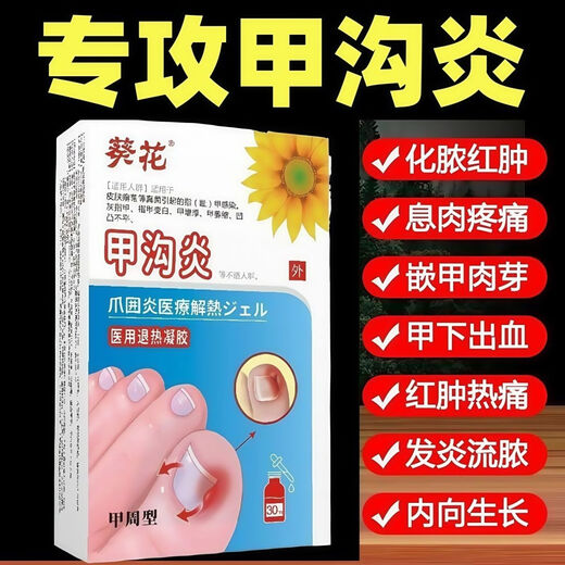 Nanjing Tongrentang specializes in treating paronychia, special treatment for ingrown toenails, redness, swelling and pain, granulation and polyp removal, swelling and suppuration, deep foot care 1 box Tongrentang