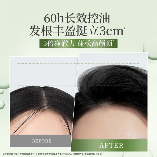 Ziyuan Wuwanzi Shampoo Long-lasting Oil Control Shampoo Remover from Dandruff Relieve Itchy Fluffy Silicone-free Oil No. 1 Men and Women 400ml