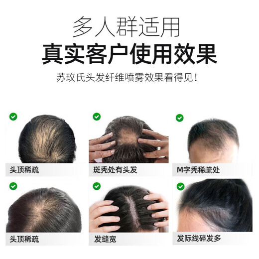 Sumei's (COMOOS) hair fiber powder to modify and style wig powder fiber to repair hair artifact to fill bald fluffy powder hairdressing wig powder 25g black + 100ml styling water