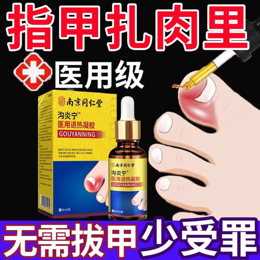 Nanjing Tongrentang specializes in treating paronychia, special treatment for ingrown toenails, redness, swelling and pain, granulation and polyp removal, swelling and suppuration, deep foot care 1 box Tongrentang