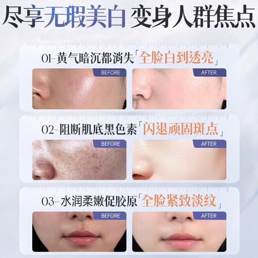 维特丝377精华水乳液美白祛斑补水保湿男女士护肤品淡化黑色素舒缓修护