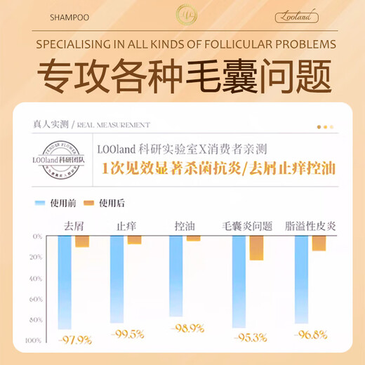 LD imported raw materials for men and women, hair follicle dandruff, anti-itch, oil control, fluffy, mite-removing cleansing shampoo, three bottles of family pack, a must-have for stocking up