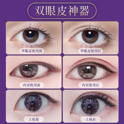 Xizi Duoduo double eyelid styling cream single eyelid double swollen and saggy eyelids long-lasting waterproof invisible double eyelid glue double eyelid styling cream 2 pieces 10ml