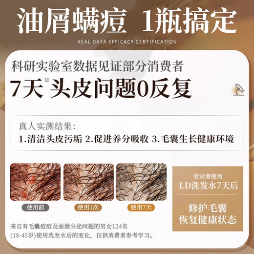 LD imported raw materials for men and women, hair follicle dandruff, anti-itch, oil control, fluffy, mite-removing cleansing shampoo, three bottles of family pack, a must-have for stocking up