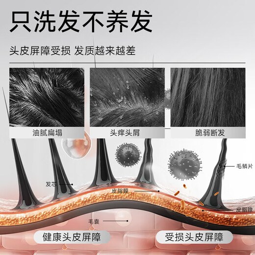 Fan flexible [Big Brand Trial] Champú de jengibre de Fan Chengcheng que el cabello pequeño y saludable de estilo pequeño