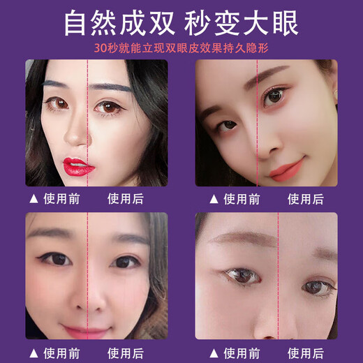Xizi Duoduo double eyelid styling cream single eyelid double swollen and saggy eyelids long-lasting waterproof invisible double eyelid glue double eyelid styling cream 2 pieces 10ml