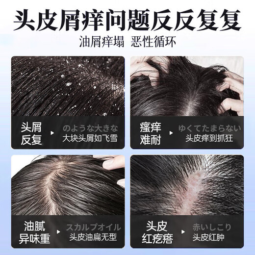 南京同仁堂二硫化硒洗发水去屑止痒控油持久蓬松洗头露脂溢性毛躁男女士专用