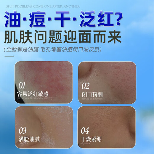 Redact Australian Amino Acid Teenagers Facial Cleanser 12-16 Years Old Oil Control and Acne Removal Adolescent Students Boys and Girls Facial Cleanser