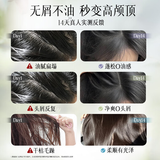 Wits Shampoo for Men and Women Anti-dandruff Anti-Itch Control Oil-Control Long-lasting Fluffy Shampoo Amino Acid Gold List No. 1 Shampoo