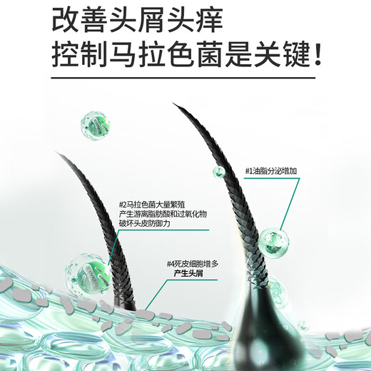 舒蕾氧活O2 Dynamic止痒去屑双专利洗发水 400g 清凉 老牌国货