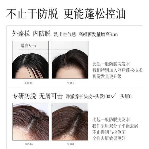 NOUGAT进口防脱洗发水控油蓬松固发养发防断发掉发洗发露男女通用