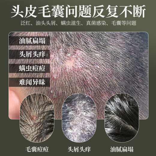 HIEUAILR德国品牌毛囊清洁洗发水去屑止痒控油蓬松除螨男女士持久留香洗膏 【一瓶见效装】净澈控油止痒去屑