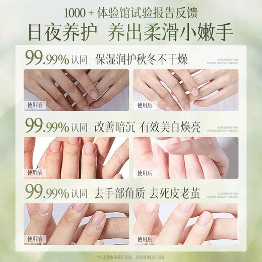 BEAIB5 hand cream 2 bottles, hydrating, moisturizing, improving dryness, whitening, light fine lines, roughness, anti-cracking gift box for men and women