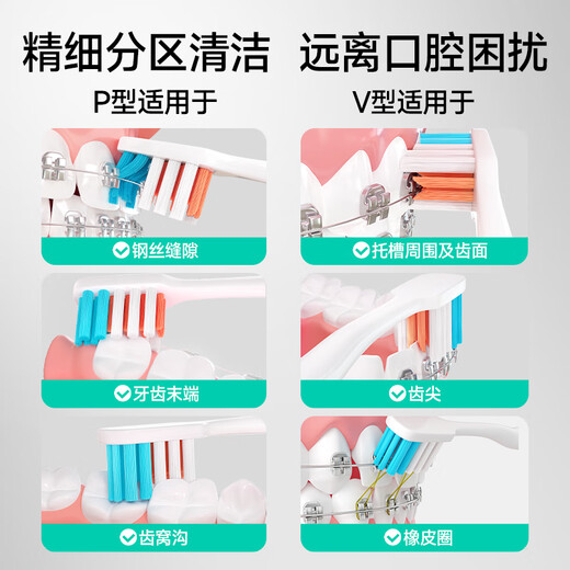 Meyarn orthodontic toothbrush PV type 2 pack, interdental brush, teenager toothbrush, brace correction period, soft hair, small head