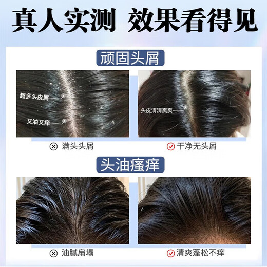 南京同仁堂二硫化硒洗发水去屑止痒滋养头皮控油蓬松毛囊清洁头屑止痒男女士 二硫化硒洗发水1瓶300ml