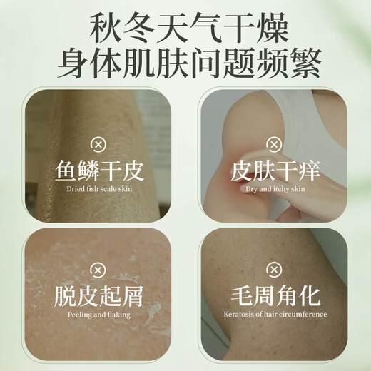 Centennial Bian's Wormwood Anti-Itch Body Lotion is light, moisturizing and moisturizing for dry and itchy skin. It moisturizes dry and flaky skin all over the body. Anti-itch Body Lotion 2 bottles.