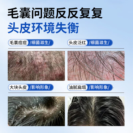 LEASCAN二硫化硒洗发水去屑止痒洗剂控油蓬松男女士专用毛囊清洁洗发液露