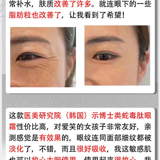 示博士【香港大药房】蛇毒肽去眼袋眼霜黑眼圈脂肪粒去细纹紧致抗皱保湿 3瓶【中度眼袋适用】