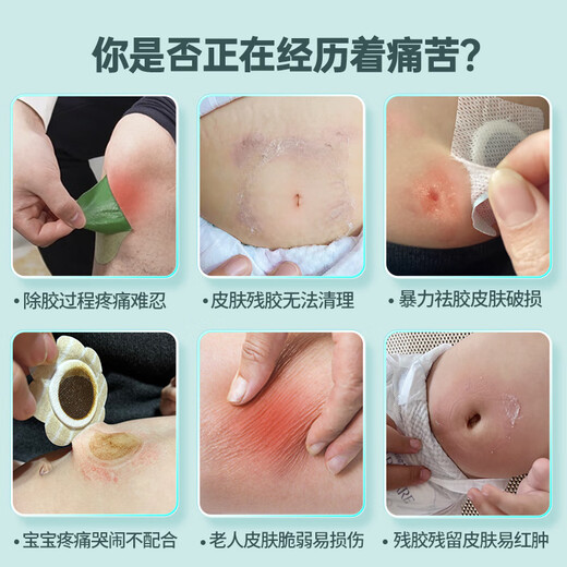 
Crafting stoma chassis viscose stripping spray quick glue removal agent medical glue removal agent alcohol-free Kanglebao12010 [1 bottle] 1702 chassis stripping agent