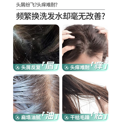 舒蕾氧活O2 Dynamic止痒去屑双专利洗发水 400g 清凉 老牌国货