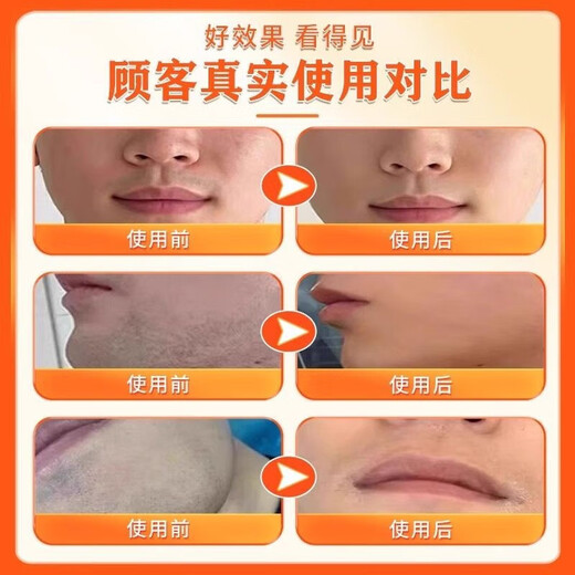 Hong Kong Pharmacy Hu Qing's special concealer for removing stubble, beard, and lip hair, special for removing black marks on beards. Buy two, get one free. Special effect. Refuse to repeat.