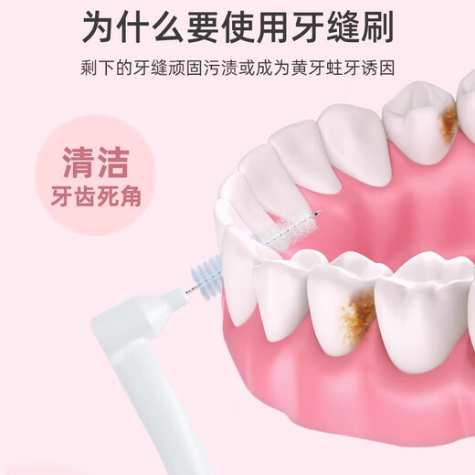 
L-shaped interdental brush imported steel wire orthodontic toothbrush orthodontic toothbrush soft tooth gap brush L-shaped interdental brush-white-10 pieces