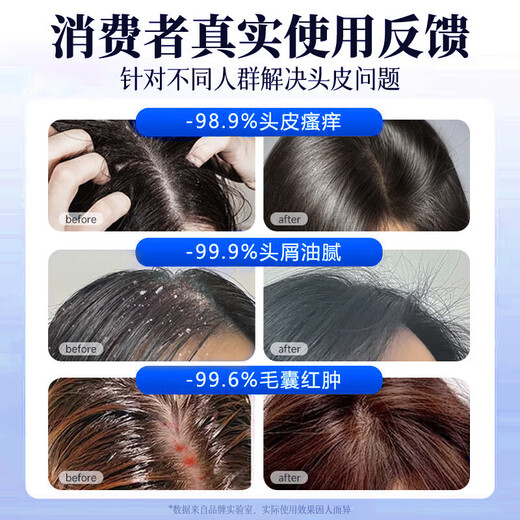 南京同仁堂二硫化硒洗发水去屑止痒控油持久蓬松洗头露脂溢性毛躁男女士专用