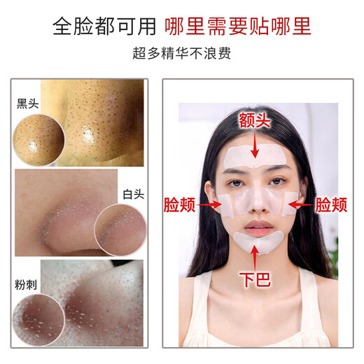 Ruwei (RNW) blackhead removal nose mask 5 sets of 10 pieces tear-free ramen mask export essence acne shrinkage