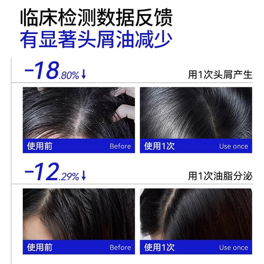 
EHD Selenium Disulfide Oil Control Anti-dandruff Shampoo Hair Follicle Cleaning Flush Shampoo 400ml