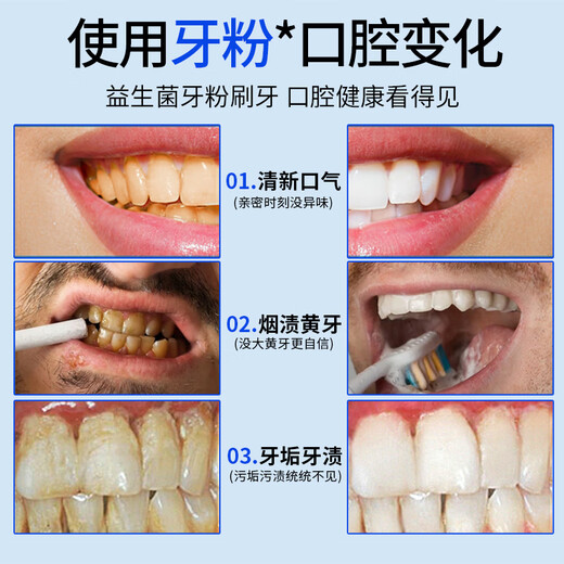 DR.SOKK洁牙粉美白去黄洗牙粉口臭黄去牙渍去烟渍牙结石牙齿清洁器除牙垢