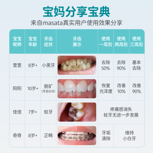Masata新加坡进口儿童牙膏0-3-6-12岁专效防蛀固齿宝宝含氟牙膏龋齿护龈