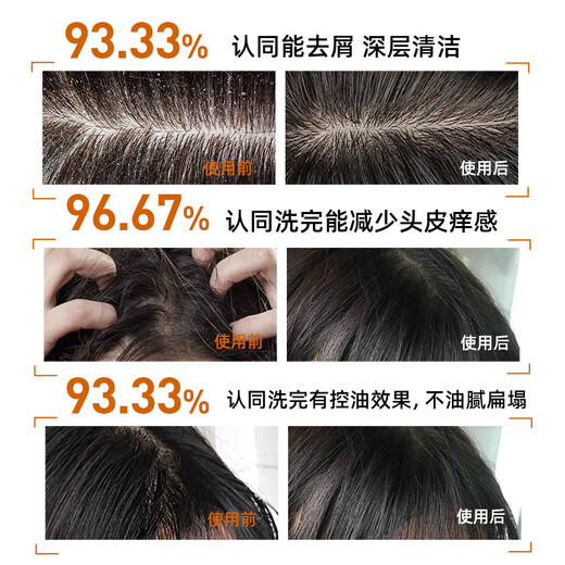 采乐同康去屑止痒洗发水二硫化硒控油蓬松洗发露女通用1050ml